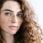 Apa Itu Freckles? Pengertian, Ciri-ciri, Penyebab, dan Cara Menghilangkannya