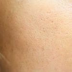 Cara mengecilkan pori-pori kulit