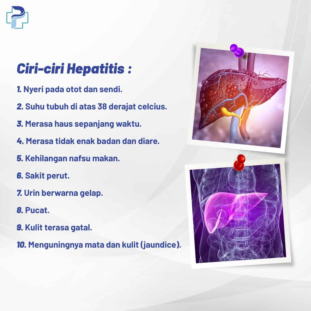 ciri ciri hepatitis