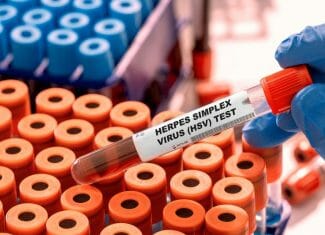 Penyakit Herpes Pada Kulit Dan Kelamin Bisa Sembuh?