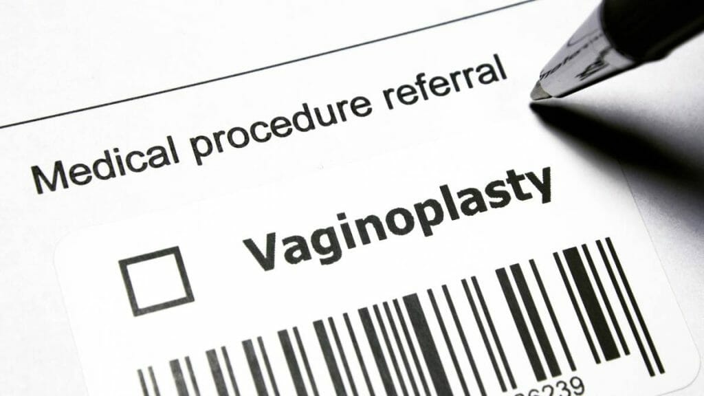Ilustrasi Biaya Vaginoplasty