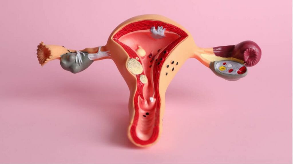 Ilustrasi Operasi Vaginoplasty