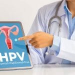 Infeksi HPV