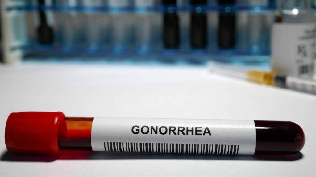 Tes Darah Untuk Diagnosis Gonore