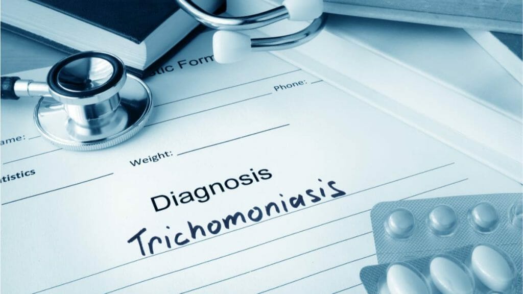 Diagnosis Trikomoniasis 2