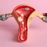 Laser Vaginal Rejuvenation di Klinik Utama Pandawa