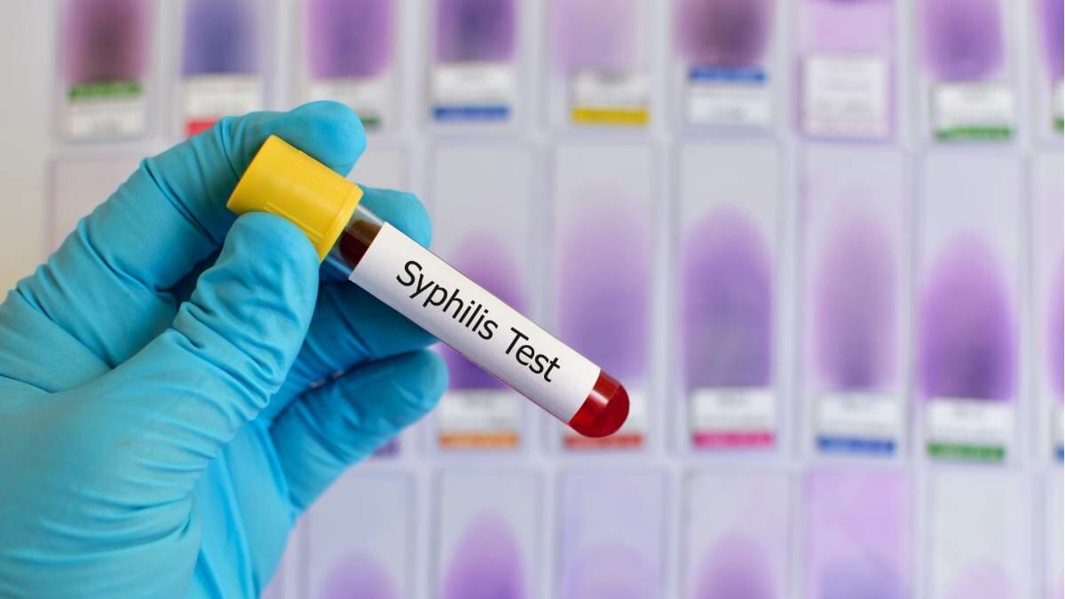 Pemeriksaan Sifilis untuk Mengobati Sifilis