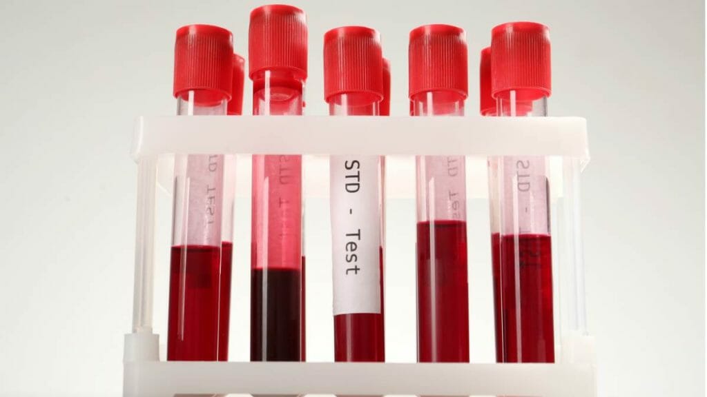Tes Darah Di Klinik Kelamin Jakarta