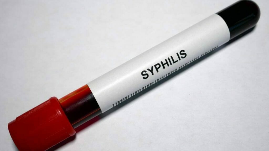 Apakah Sifilis Bisa Sembuh Sendiri 2