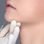 Apa itu Botox Rahang? Ketahui Manfaat, Prosedur, & Harga