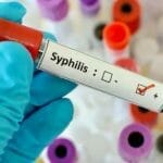 Peran Spesialis Sifilis dalam Pengobatan - Klinik Pandawa