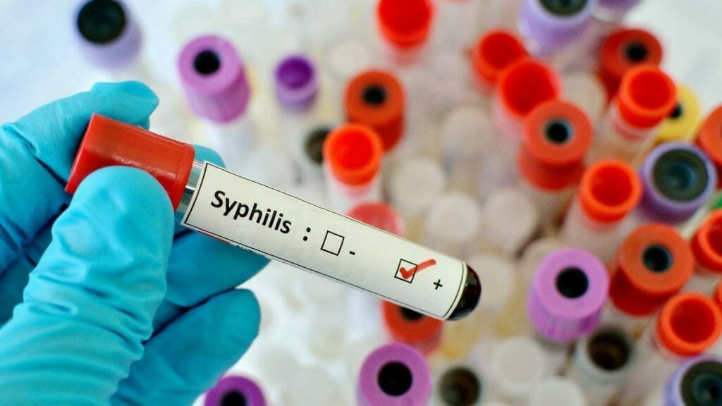 Penyebab Sifilis 2