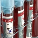 Sering Dianggap Sama, Ini Perbedaan HIV dan AIDS (2)