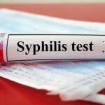 5 Cara Penularan Sifilis atau Raja Singa - Klinik Pandawa