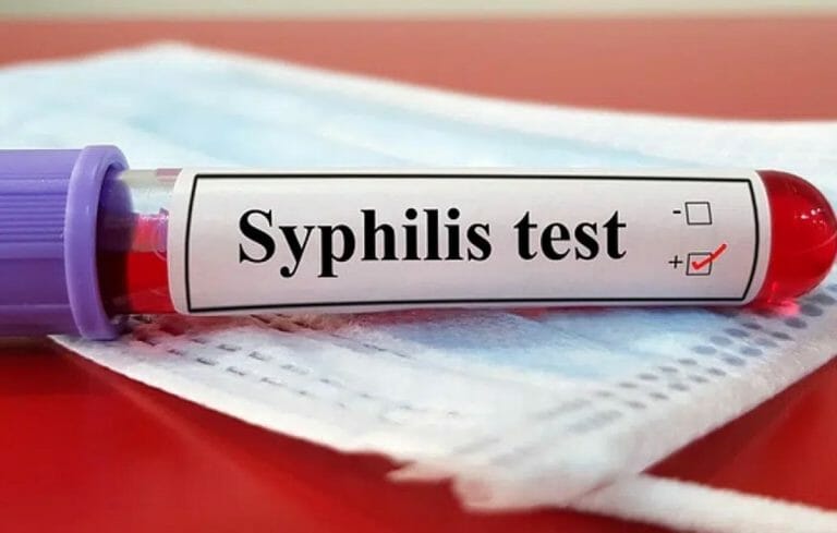 Penularan Penyakit Sifilis 2