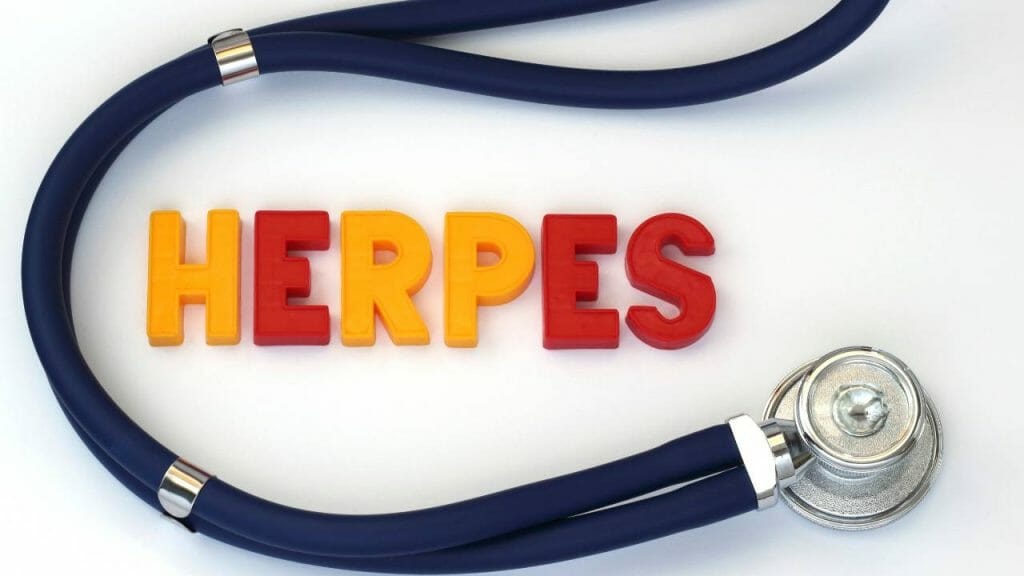 Berapa Lama Herpes Kelamin Sembuh