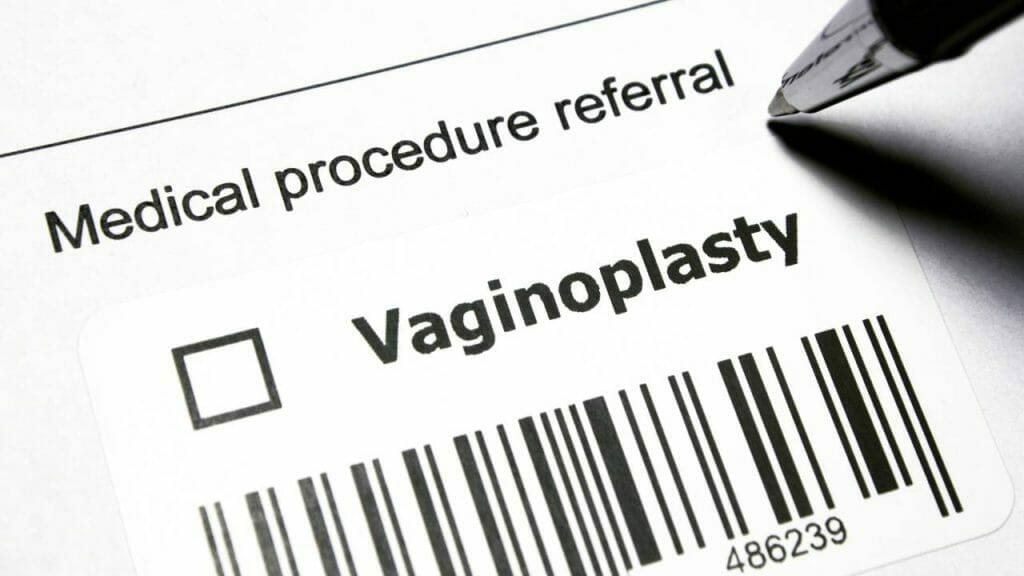 Cara Mengencangkan Vagina Dengan Vaginoplasty