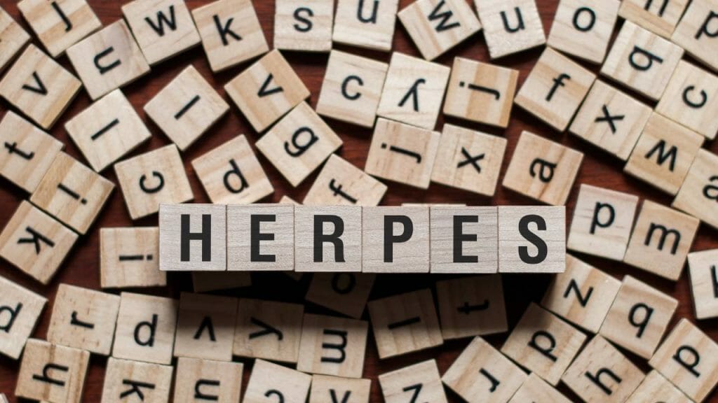 Cara Pengobatan Herpes Kelamin 2