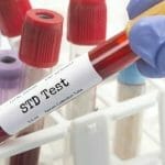 Menavigasi Harga Tes STD untuk Kesehatan Seksual yang Lebih Baik