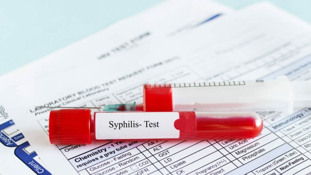 Prosedur Pemeriksaan Serologi Untuk Deteksi Sifilis
