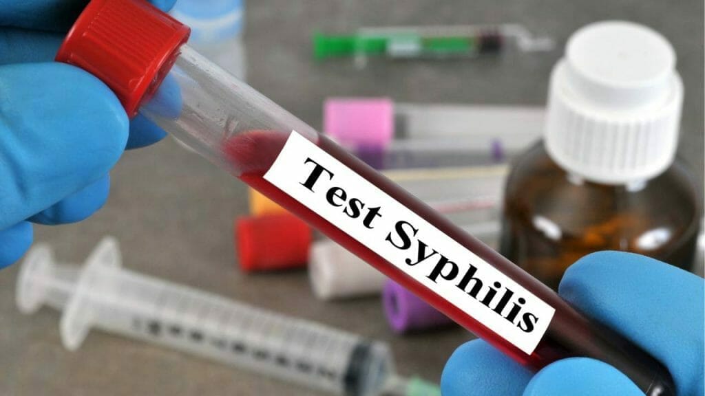 Tes Darah Untuk Ulkus Durum Sifilis