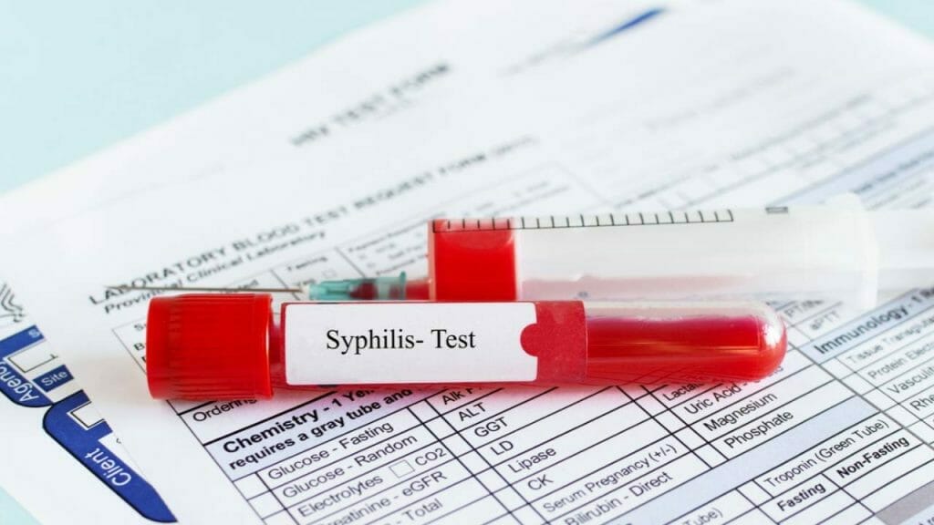 Tes Darah Untuk Mengetahui Sifilis
