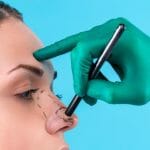 Berapa Lama Penyembuhan Operasi Hidung