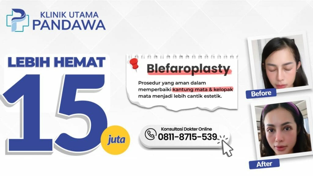 Blepharoplasty Before After Promo Operasi Kelopak Mata Di Klinik Utama Pandawa Jakarta 1