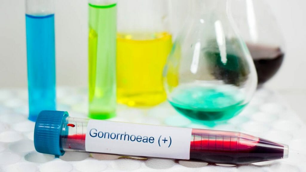 Cara Mendiagnosis Dan Mengetahui Seseorang Terinfeksi Gonore