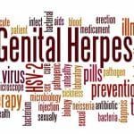 ciri ciri herpes genital akan sembuh