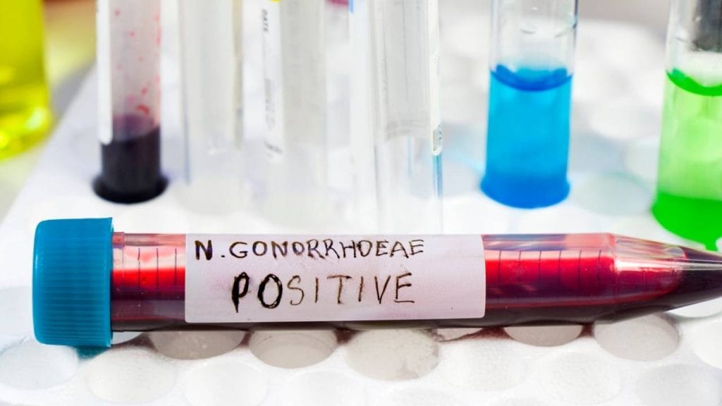 Pemeriksaan Untuk Mendeteksi Gonore Di Laboratorium