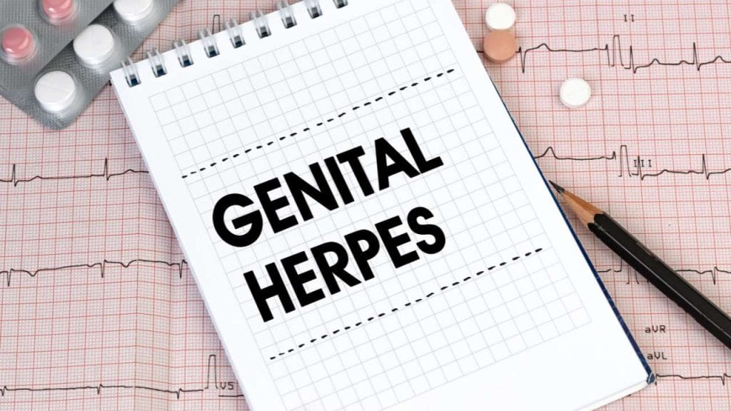 Pengobatan Herpes Kelamin