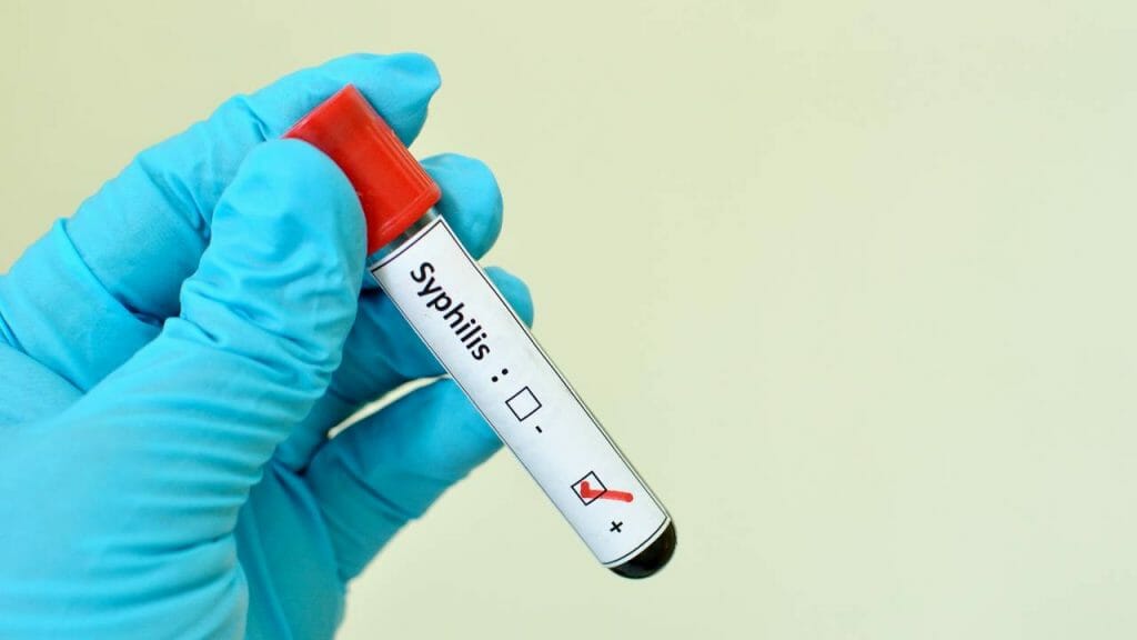 Tes Sifilis Di Klinik Utama Pandawa