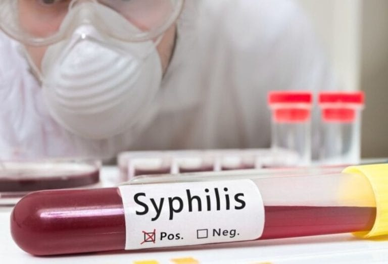 Ilustrasi Apakah Sifilis Menyebabkan Kemandulan