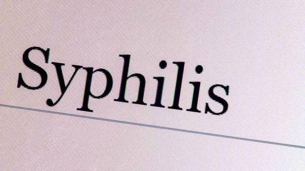 Ilustrasi Penyakit Sifilis