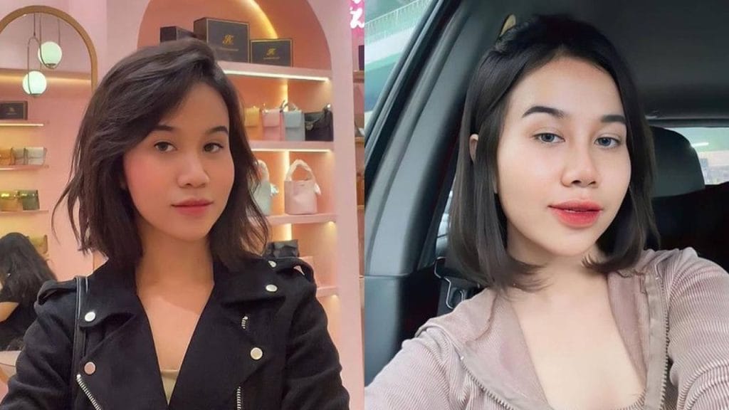 Mayang Fitri Before And After Rhinoplasty