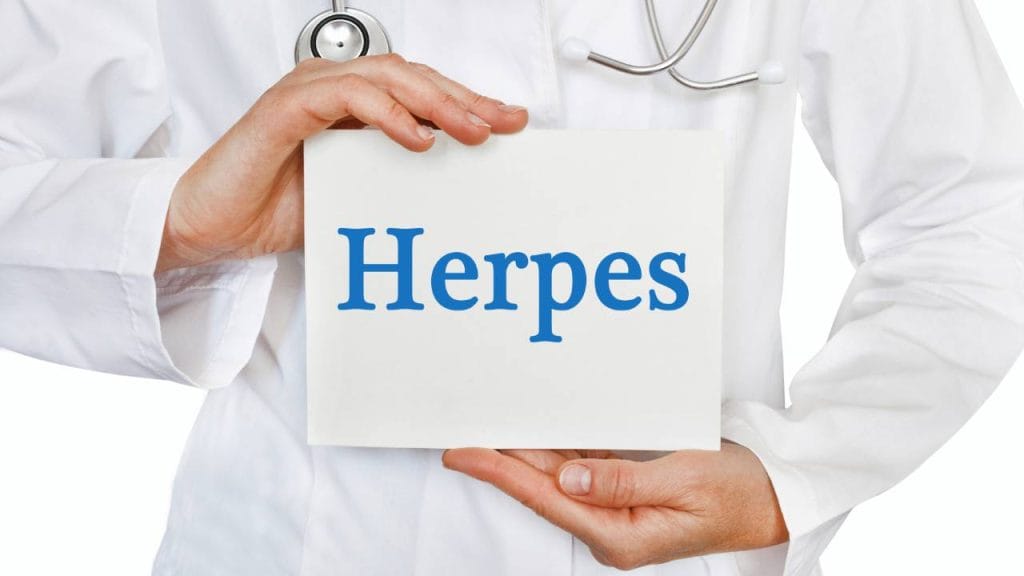 Pengobatan Herpes 2