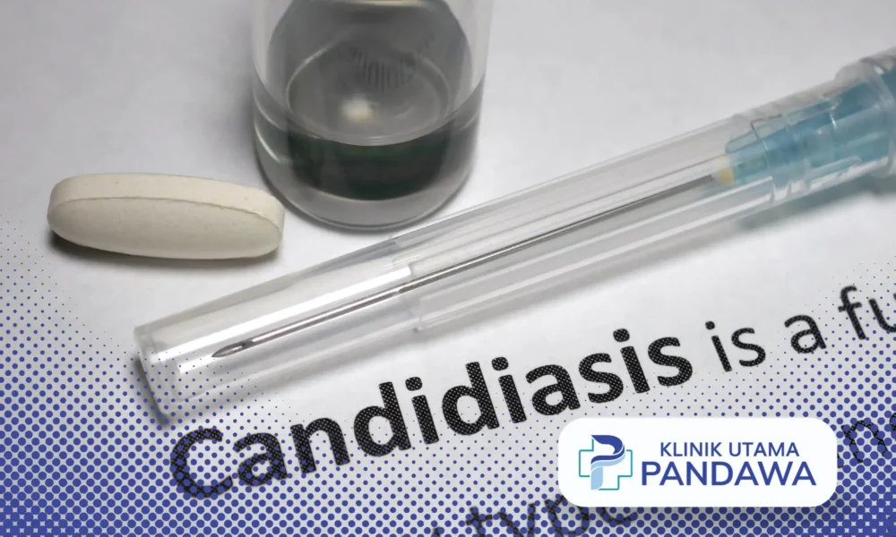 kandidiasis