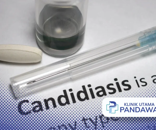 kandidiasis