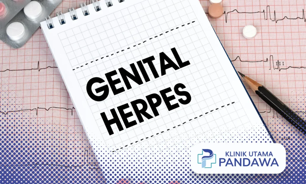perawatan herpes genital