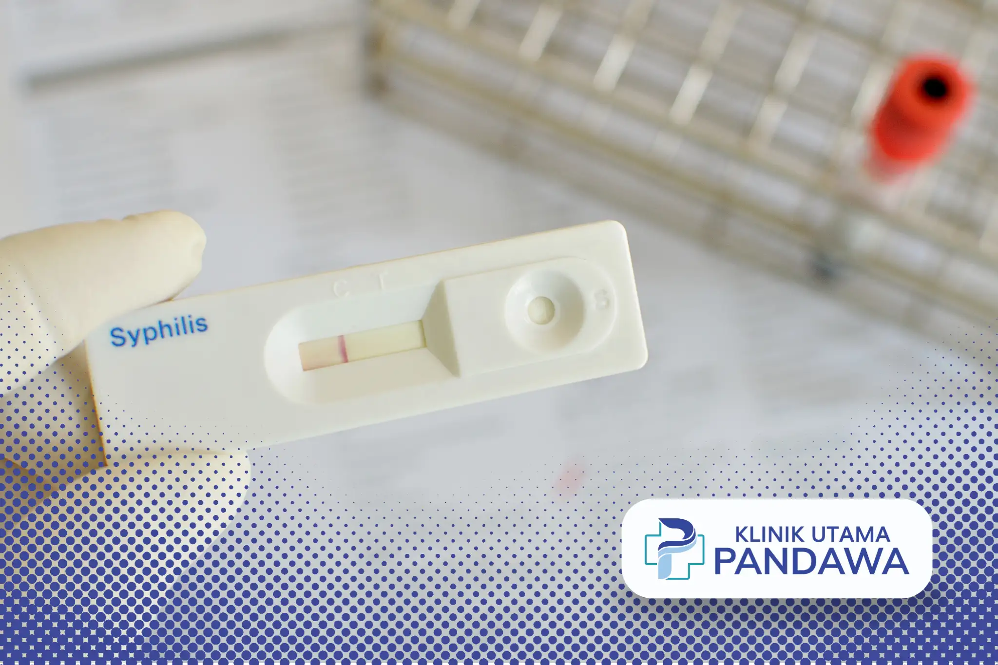 Cara Tepat Pengobatan Sifilis yang Efektif dan Aman - Klinik Utama Pandawa