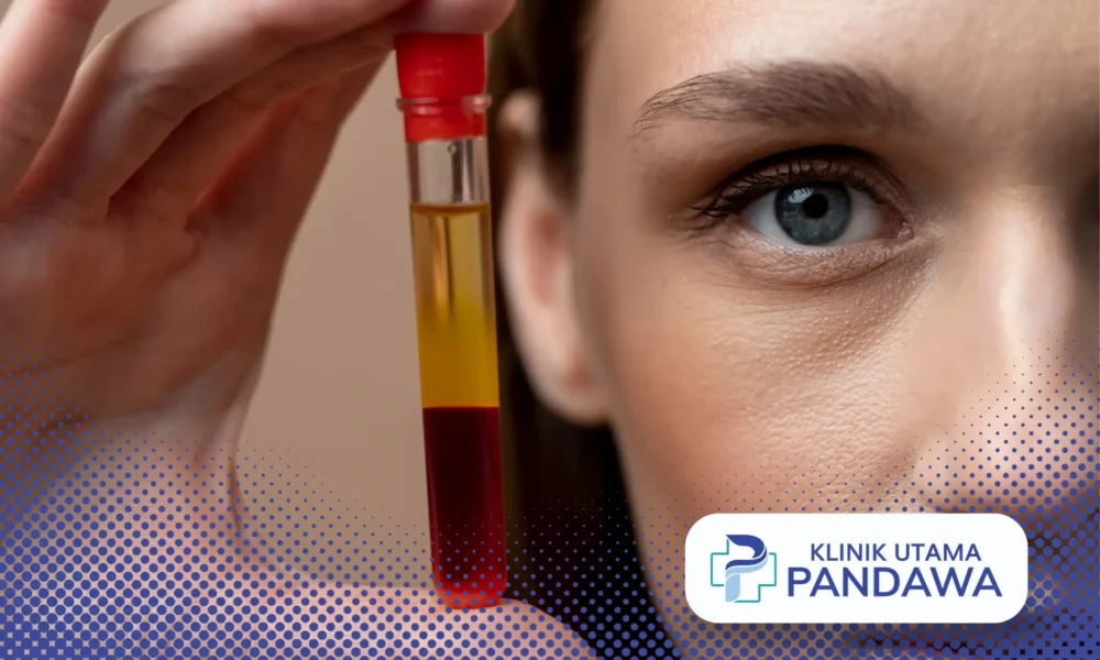 PRP Treatment