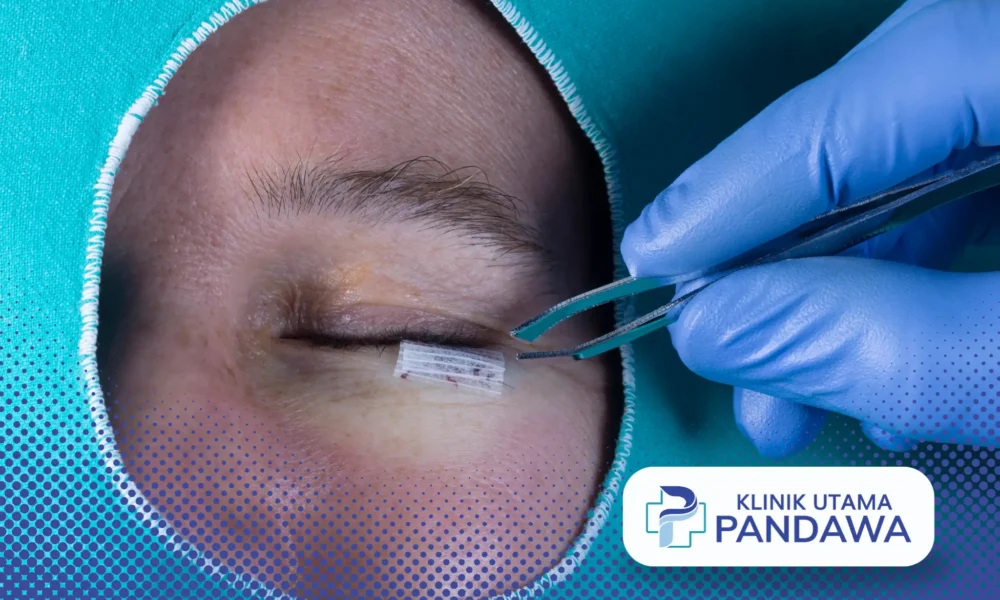 eyelid surgery