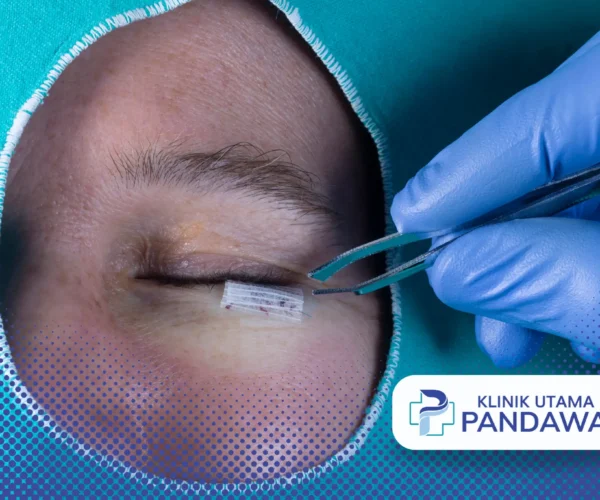 eyelid surgery
