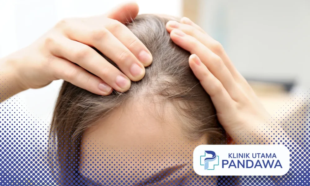 hair loss treatment