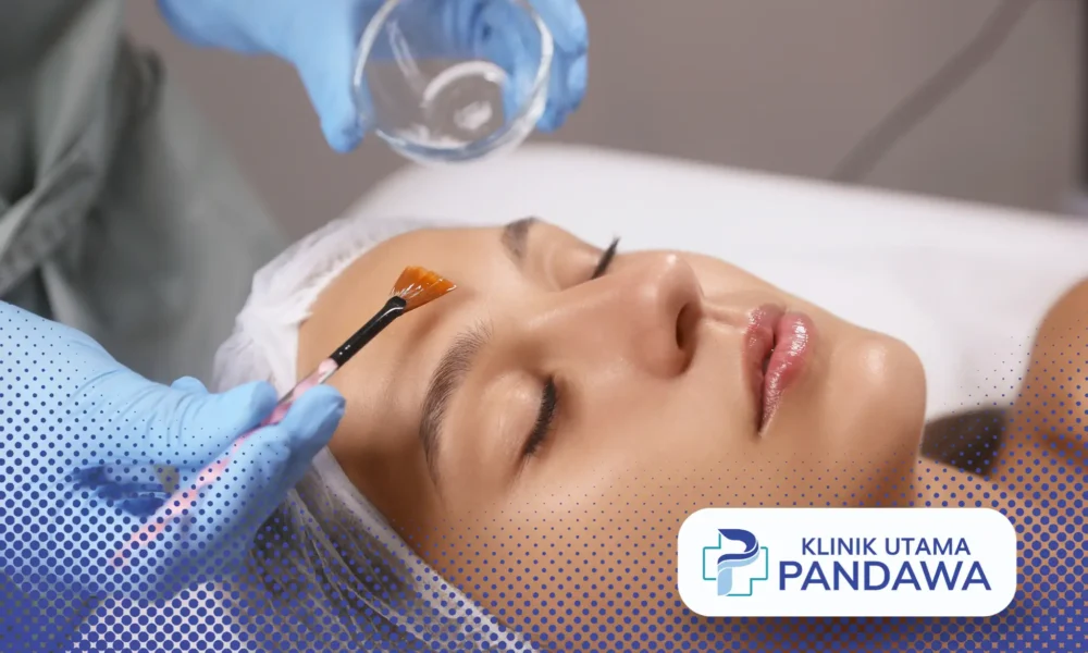 harga chemical peeling di klinik kecantikan