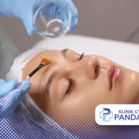 harga chemical peeling di klinik kecantikan