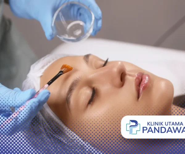harga chemical peeling di klinik kecantikan