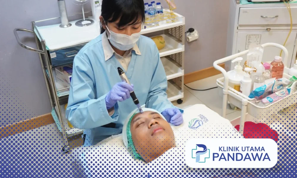 microneedling