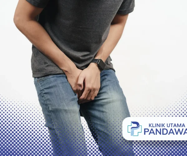 perawatan kondiloma akuminata